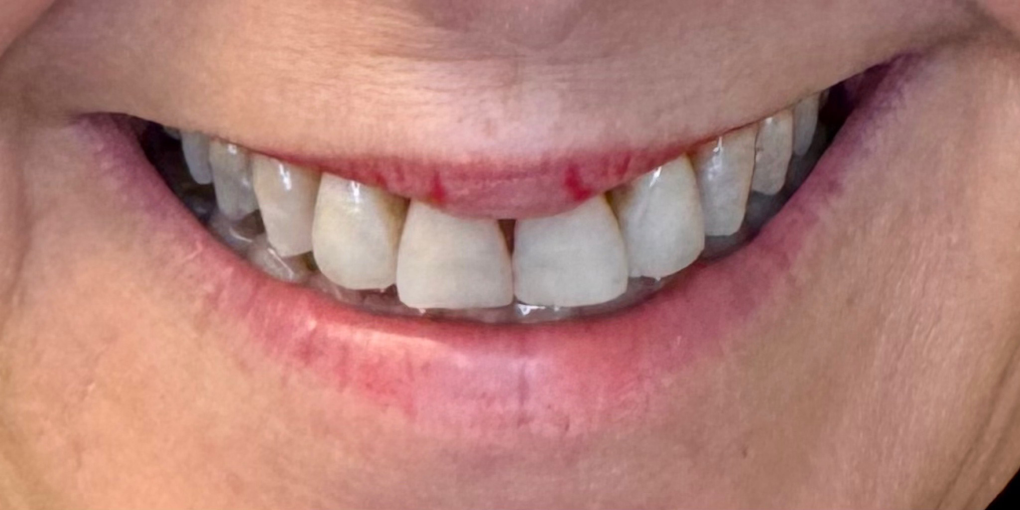 Before