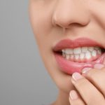 periodontal surgery aftercare tips