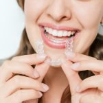 teeth straightening options adults