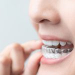 invisalign treatment benefits
